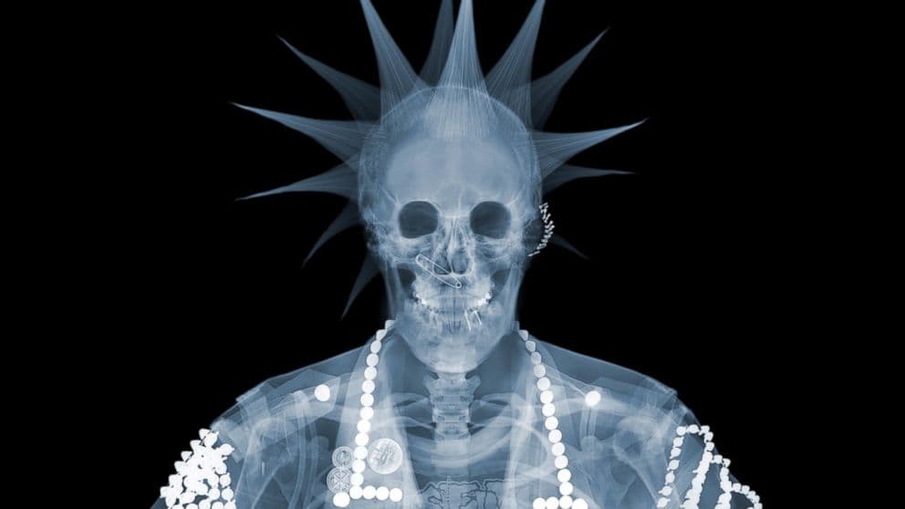 Nick Veasey